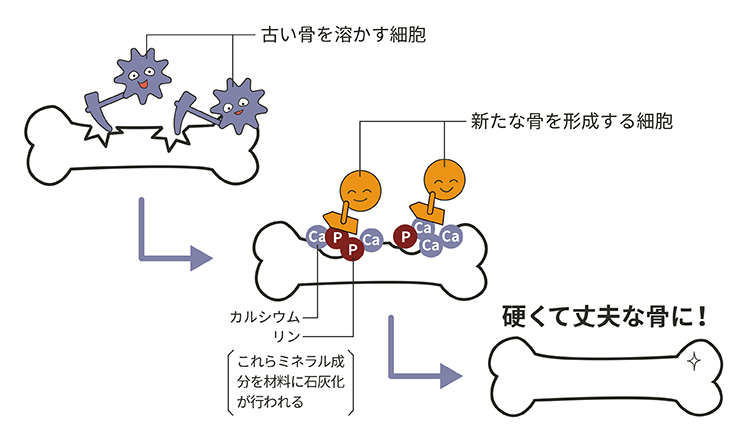 くる病・骨軟化症とは