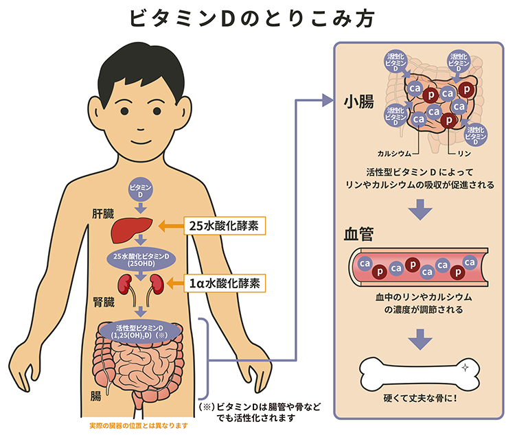 くる病・骨軟化症の3つの原因と疾患