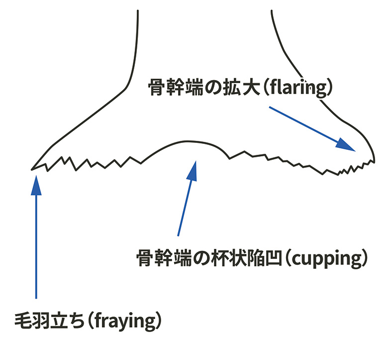 単純X線検査（レントゲン検査）